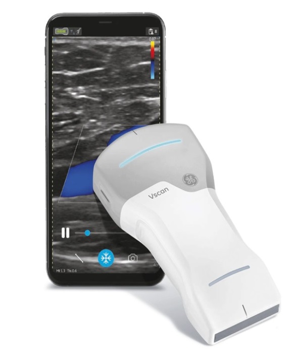 SONO Vscan Air™ CL Ultrazvuk od GE